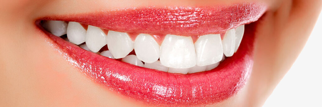blanchir-dents